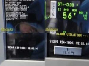 Spacelabs 91369 Ultraview SL Monitor Masimo SpO2 Module Opt: ICGMRS, Leads~30567