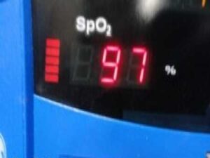 2015 GE Dinamap Carescape V100 Patient Monitor W/ PSU, Leads & Stand ~ 32246