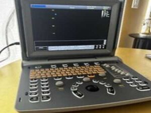 Color Doppler Portable Ultrasound Chison ECO5 Human Vascular/MSK/Abdominal