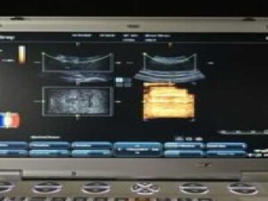 Mindray M7 Ultrasound System with 7L4-S Probe, Mobile Trolley, and Original Carr