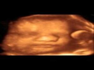 ultrasound machine