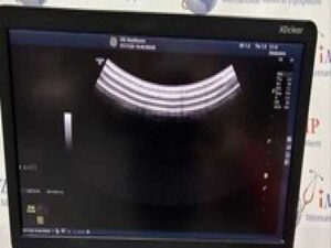 GE C1-5 Ultrasound Probe / Transducer
