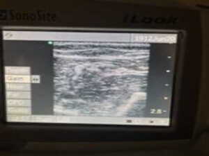SonoSite iLook 25 Personal Imaging Tool, Good Working USED REF#: P02976-04