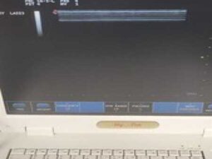 esaote MyLabFive Ultrasound Machine MyLab 5 With Linear Transducer Probe