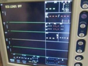 Criticare nGenuity IPX1  Patient Monitor.