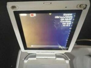 2015 GE Vscan Portable Ultrasound w/ Single Head Probe (SN: 605UZ)
