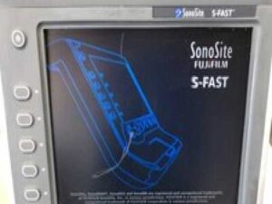 SonoSite S-Fast P07578 Portable Ultrasound Machine