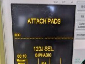Zoll M Series Biphasic Patient Monitor MFC ECG - Yellow (No Paddles)