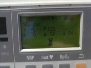 2005 Philips M1350B Series 50XM Maternal Fetal Monitor W/Leads,Transducers~31049