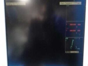 Fukuda Denshi DS-7200 Series Dynascape Monitor W/ Microstream CO2,Leads ~ 31011