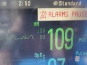 2006 Philips Intellivue MP50 Anesthesia Patient Monitor W/ Leads & Modules~36870