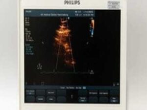 Philips CX50 Diagnostic Ultrasound System Revision 3.1.2 With AC Adapter Charger