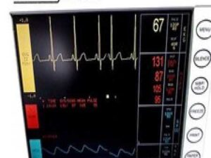 Pace Tech MiniMax 4000 CL6 Monitor W/ New SpO2 EKG NBP Leads & Adapter ~12313