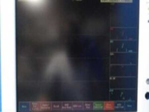 Fukuda Denshi Dynascope Monitor, DS-7200 W/ Patient Leads, New ~ 31685