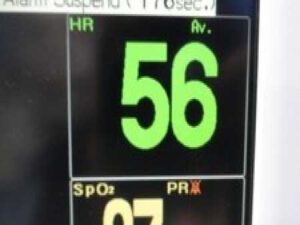 Fukuda Denshi DS-7210 Dynascope Monitor W/ SpO2,NBP,ECG,Temp,IBP Leads ~ 31925