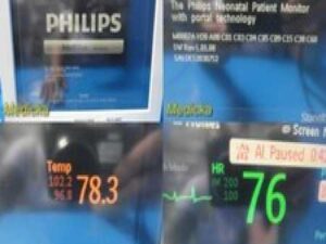 Philips Intellivue Neonatal MP70 Monitor Ref M8007A W/ Module & Leads ~ 32127