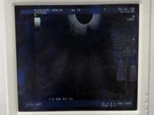 ALOKA SSD-3500SX ULTRASOUND W/ UST-9123 (ANGIO) AND UST-9124 (ENDOCAVITY) PROBES