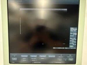 BK MEDICAL FLEX FOCUS 400 ULTRASOUND 1202 SYSTEM