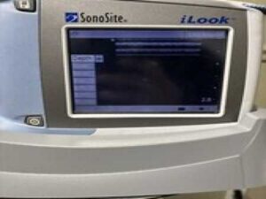 Sonosite iLook Ultrasound Machine