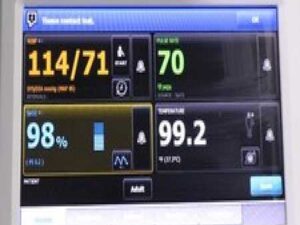 Welch Allyn 6000 Series Vital Signs Monitor
