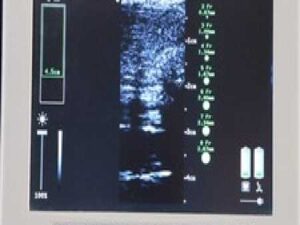 Bard SiteRite 5 Ultrasound Machine