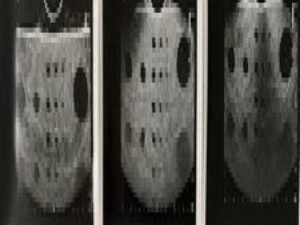 BK Medical Ultrasound Probe  E14C4t (9018)  Endo - Vaginal TV